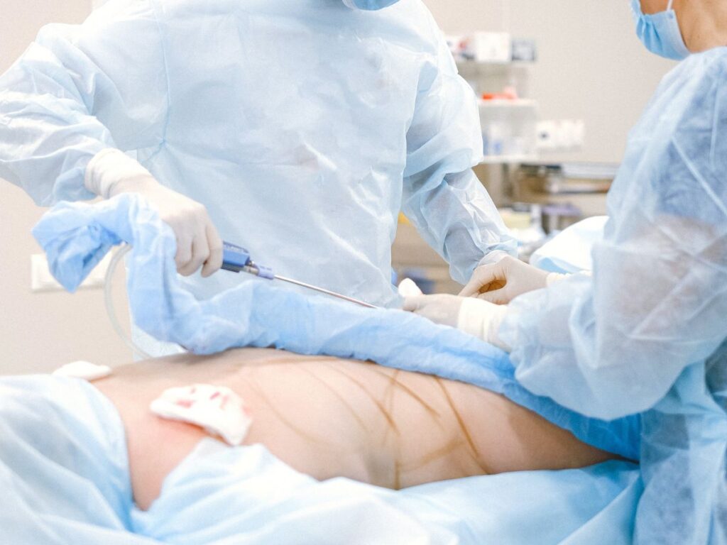 marking body of patient