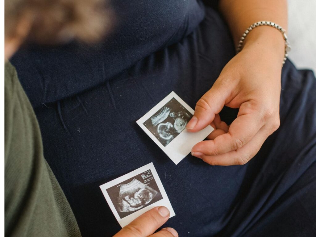 holding sonographs 