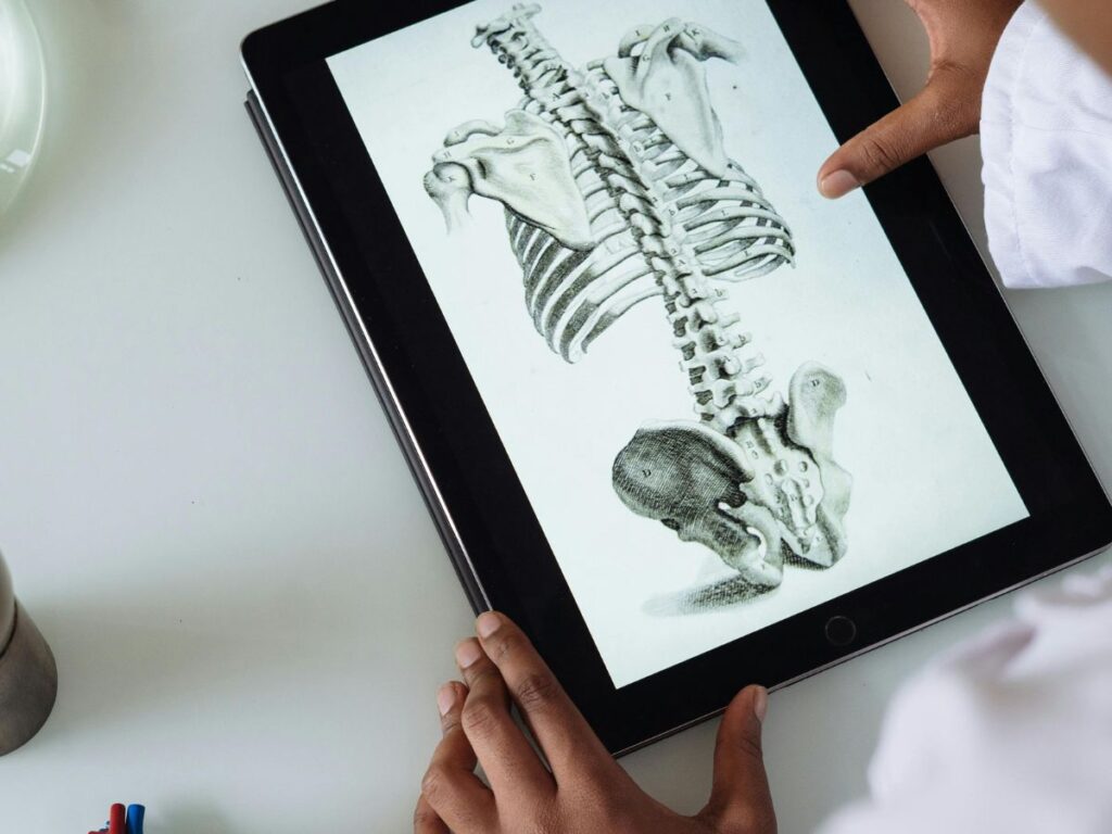 checking a bone scan on tablet